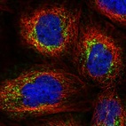 Immunofluorescent staining of human cell line A-431 shows localization to vesicles.