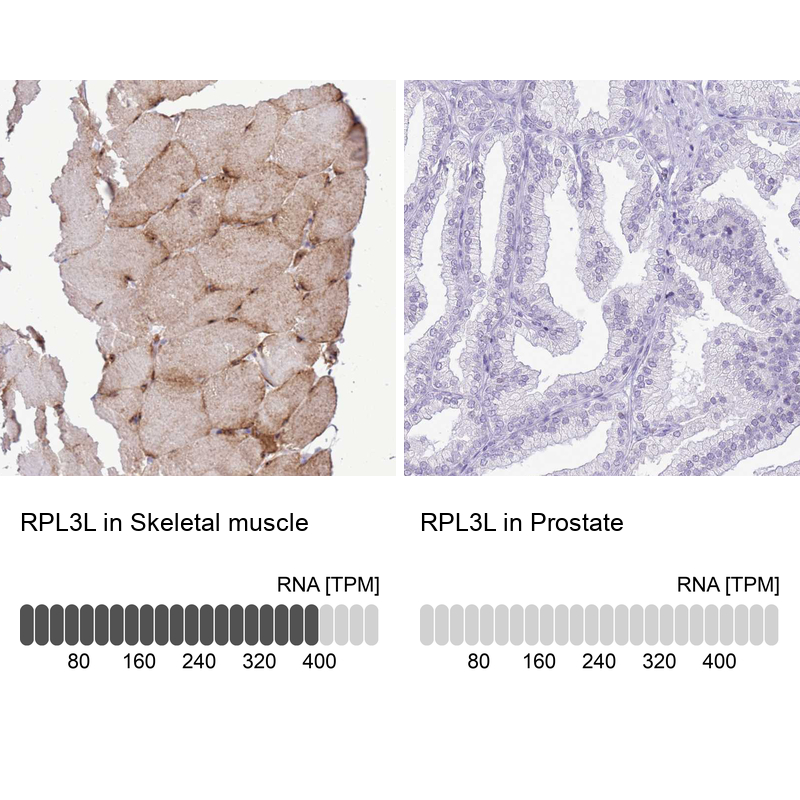 Anti-RPL3L Antibody