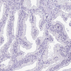 Immunohistochemical staining of human prostate shows no cytoplasmic positivity in glandular cells as expected.