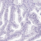 Immunohistochemical staining of human prostate shows no cytoplasmic positivity in glandular cells as expected.
