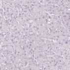 Anti-RPL3L Antibody
