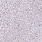 Immunohistochemical staining of human liver shows no cytoplasmic positivity in hepatocytes as expected.