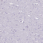 Immunohistochemical staining of human cerebral cortex shows no cytoplasmic positivity in neurons as expected.