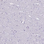 Immunohistochemical staining of human cerebral cortex shows no cytoplasmic positivity in neurons as expected.