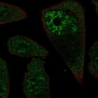 Immunofluorescent staining of human cell line PC-3 shows localization to nuclear speckles.