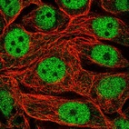 Immunofluorescent staining of human cell line MCF7 shows localization to nucleoplasm.