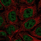 Immunofluorescent staining of human cell line CACO-2 shows localization to nucleoplasm.