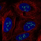 Immunofluorescent staining of human cell line U-2 OS shows localization to nucleoli.