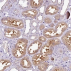 Anti-AL592183.1 Antibody