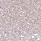 Immunohistochemical staining of human liver shows weak cytoplasmic positivity in hepatocytes.
