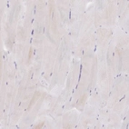 Immunohistochemical staining of human skeletal muscle shows very weak cytoplasmic positivity in myocytes.