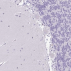 Immunohistochemical staining of human cerebellum shows no positivity in Purkinje cells as expected.