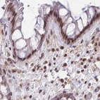 Immunohistochemical staining of human colon using Anti-HNRNPUL1 antibody HPA049475.