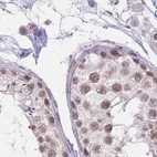 Immunohistochemical staining of human testis using Anti-HNRNPUL1 antibody HPA049475.