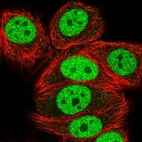 Immunofluorescent staining of human cell line MCF7 shows localization to nucleoplasm.