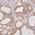 Anti-RSBN1 Antibody