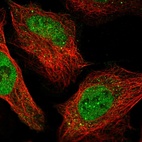 Immunofluorescent staining of human cell line U-2 OS shows localization to nucleoplasm, nuclear bodies, cytokinetic bridge & vesicles.