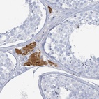 Anti-HEATR5A Antibody