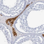 Anti-HEATR5A Antibody