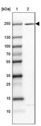 Lane 1: Marker [kDa] 250, 130, 100, 70, 55, 35, 25, 15, 10_br/_Lane 2: Human cell line SK-MEL-30