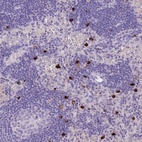 Anti-TPSD1 Antibody