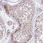 Immunohistochemical staining of human Testis shows moderate nuclear and cytoplasmic positivity in cells in seminiferous ducts.