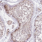 Immunohistochemical staining of human Testis shows moderate nuclear and cytoplasmic positivity in cells in seminiferous ducts.