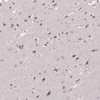 Immunohistochemical staining of human Cerebral cortex shows moderate nuclear and cytoplasmic positivity in neuronal cells.