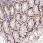 Immunohistochemical staining of human Stomach shows moderate nuclear and cytoplasmic positivity in glandular cells.