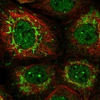 Immunofluorescent staining of human cell line A-431 shows localization to nucleoplasm, nuclear bodies & mitochondria.