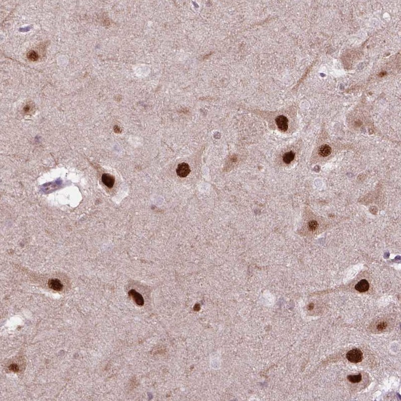 Anti-PSMC2 Antibody