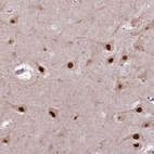 Anti-PSMC2 Antibody