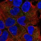 Immunofluorescent staining of human cell line HEK 293 shows localization to cytosol & cytoplasmic bodies.