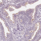 Immunohistochemical staining of human fallopian tube shows high expression.