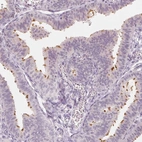 Immunohistochemical staining of human fallopian tube shows high expression.