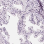 Immunohistochemical staining of human prostate shows low expression as expected.