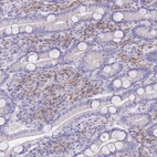 Anti-SSUH2 Antibody