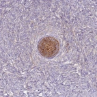 Anti-ST3GAL4 Antibody