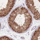 Immunohistochemical staining of human testis shows strong cytoplasmic positivity in cells in seminiferous ducts.