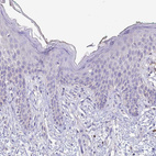 Immunohistochemical staining of human skin shows no positivity in squamous epithelial cells as expected.