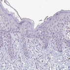Immunohistochemical staining of human skin shows no positivity in squamous epithelial cells as expected.