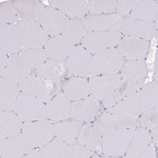 Immunohistochemical staining of human skeletal muscle shows no positivity in myocytes as expected.