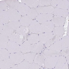 Immunohistochemical staining of human skeletal muscle shows no positivity in myocytes as expected.