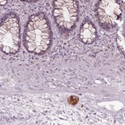 Immunohistochemical staining of human rectum shows moderate cytoplasmic positivity in peripheral nerve / ganglion.