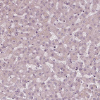 Immunohistochemical staining of human liver shows no positivity in hepatocytes as expected.