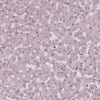 Immunohistochemical staining of human liver shows no positivity in hepatocytes as expected.