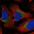 Immunofluorescent staining of human cell line U-2 OS shows localization to vesicles.