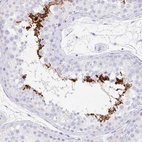 Immunohistochemical staining of human testis shows high expression.