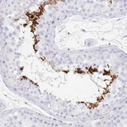 Immunohistochemical staining of human testis shows high expression.