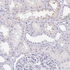 Immunohistochemical staining of human kidney shows low expression as expected.